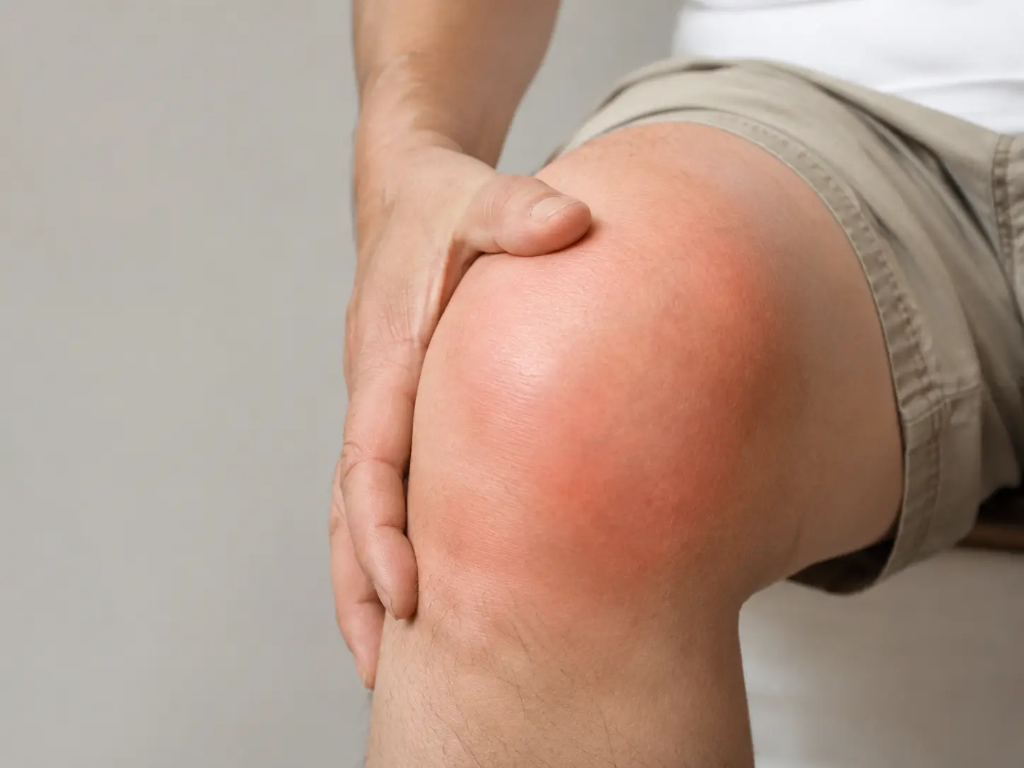 Swollen Joint
